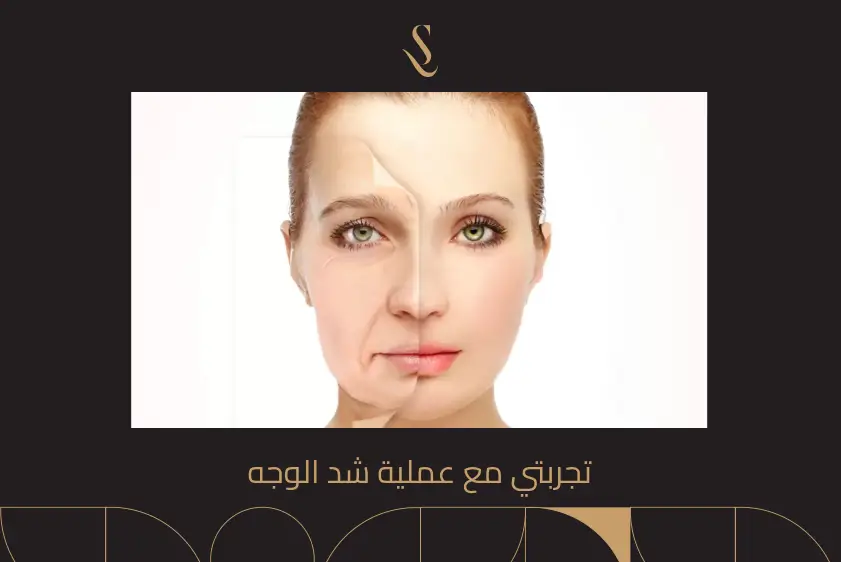 تجربتي مع عملية شد الوجه