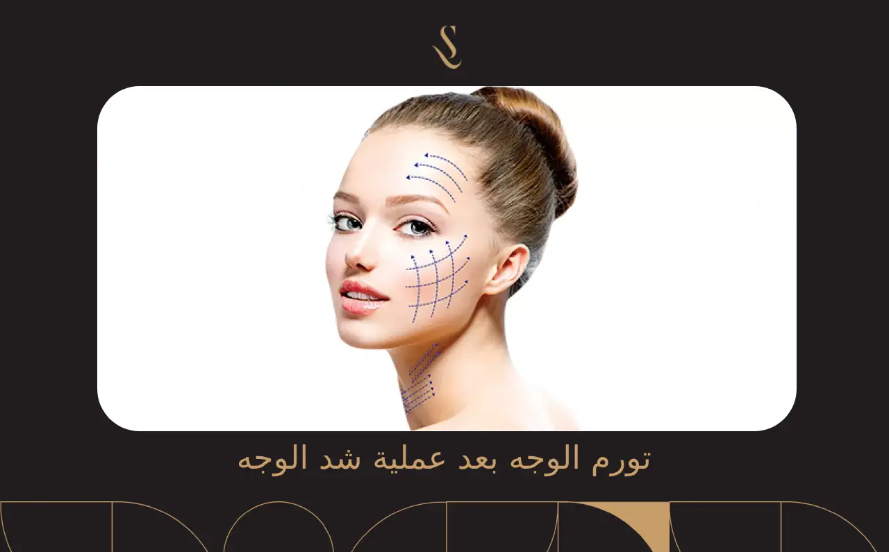 تورم الوجه بعد عملية شد الوجه