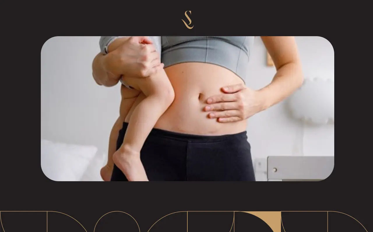 عمليات تجميل الأمومة