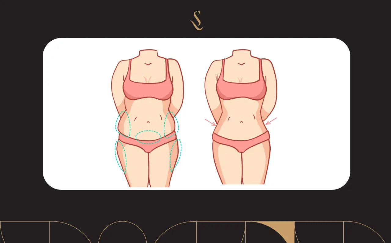 عمليات نحت الجسم