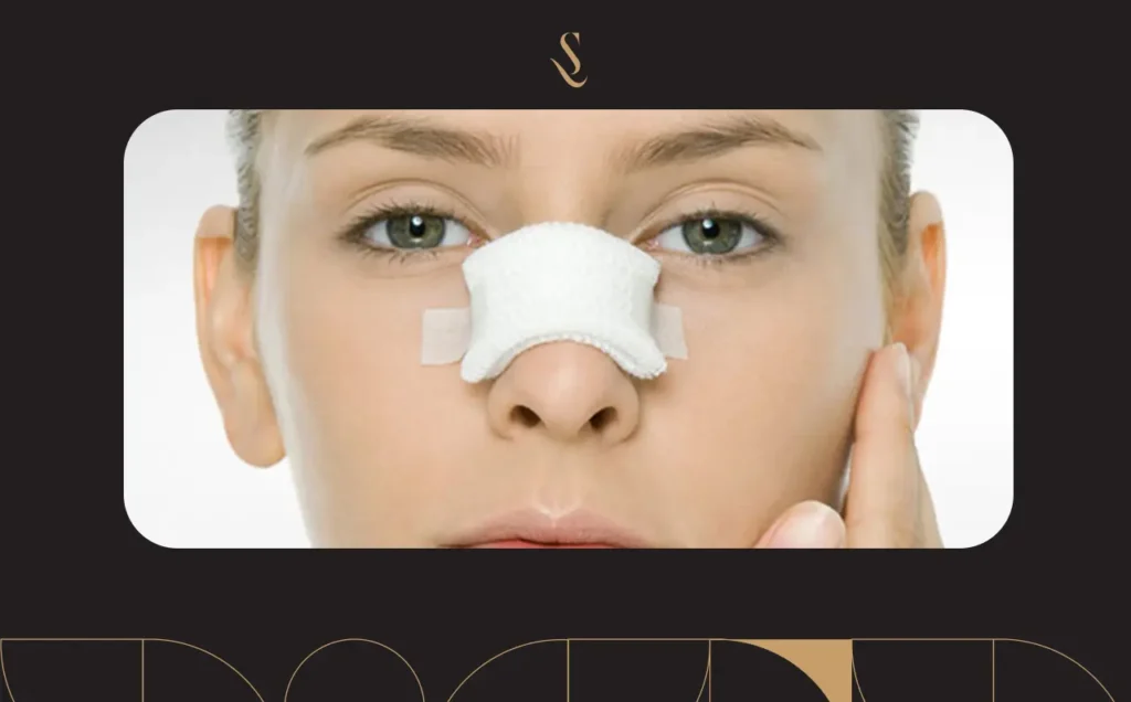 كم مدة لصقات الأنف بعد عملية التجميل