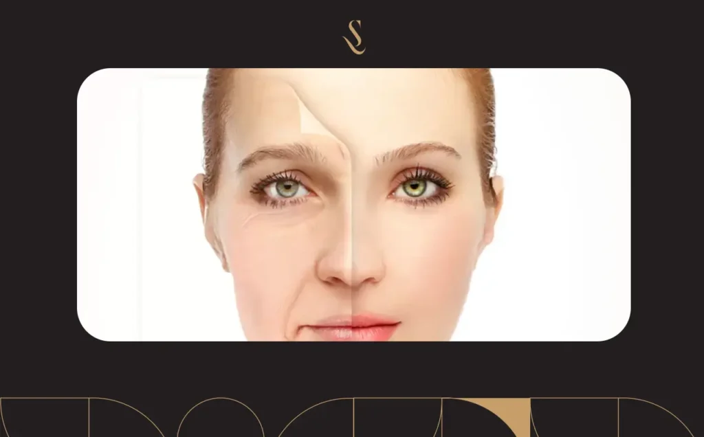 تجربتي مع خيوط شد الوجه