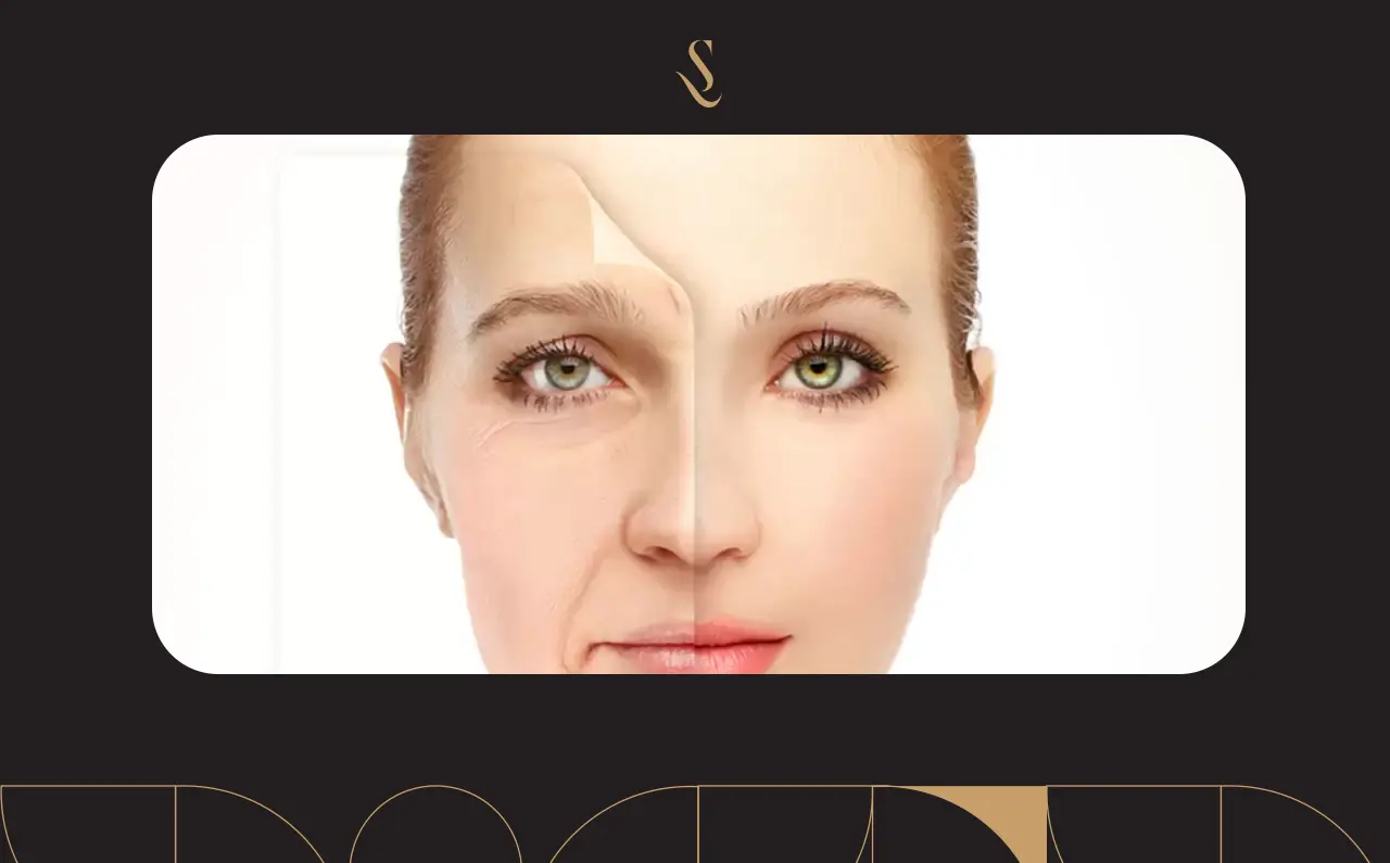 تجربتي مع خيوط شد الوجه